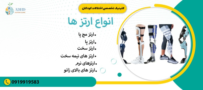 انواع ارتز ها